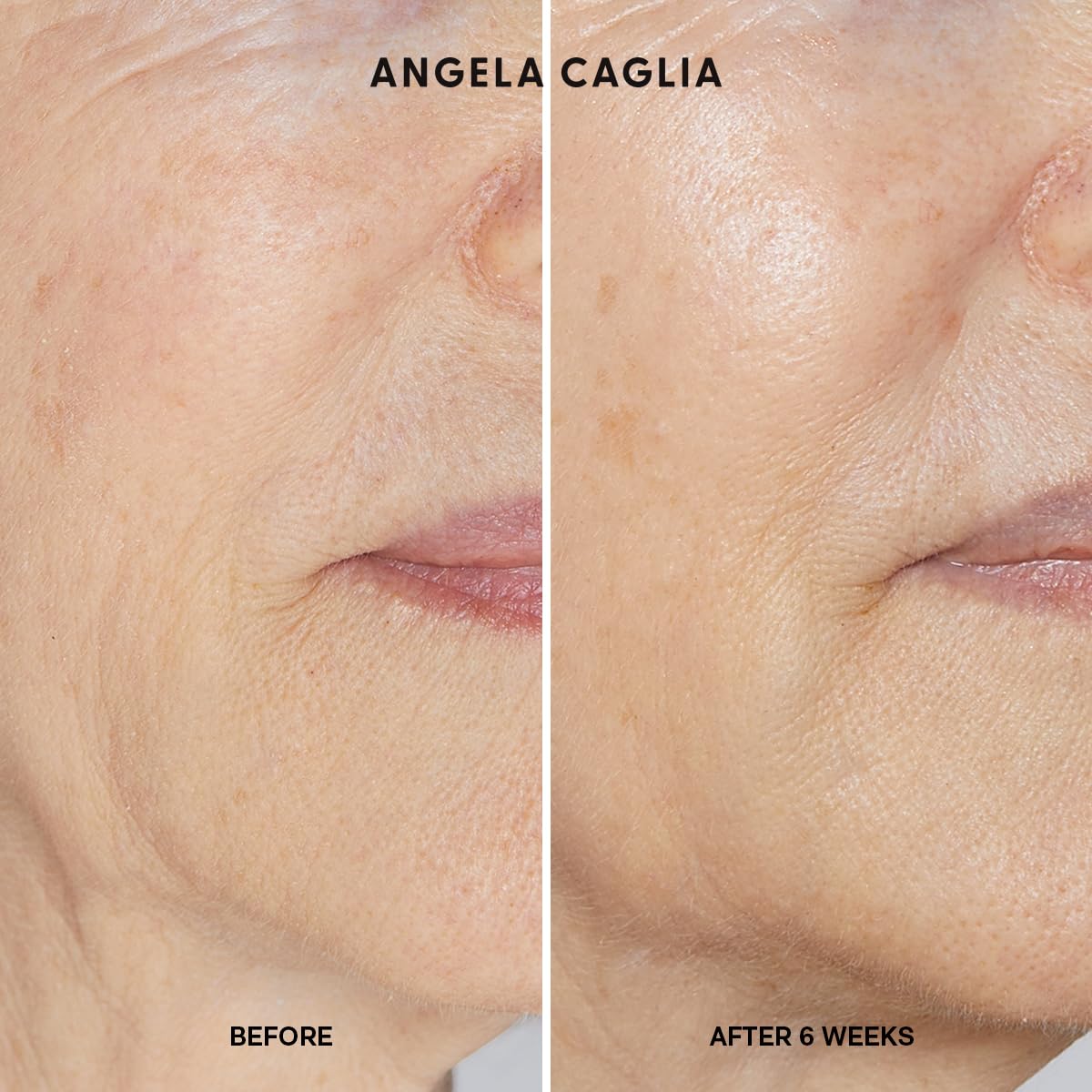 Angela Caglia Cell Forte Serum - Powered by BIOMSC™️ Skincare Technology for Fine Lines and Wrinkles